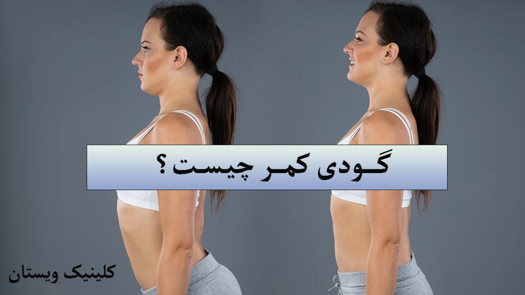یک خانم با گودی کمر و بدون آن نشان داده می شود