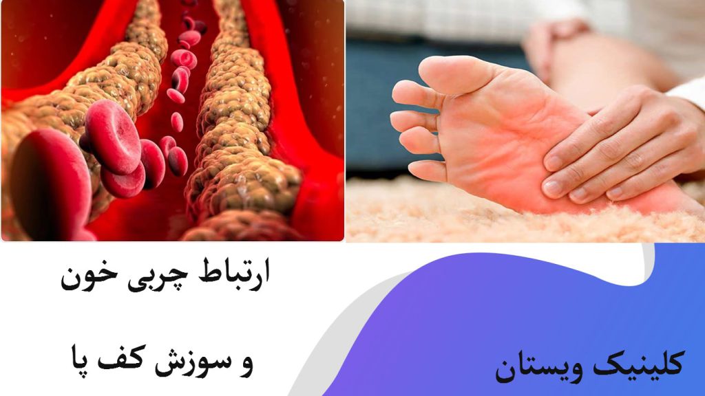 کف پا که دارای سوزش است و یک رگ که دارای چربی خون است