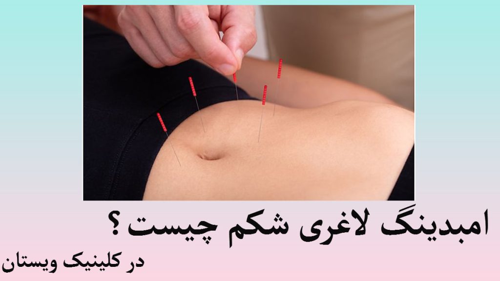 شکم یک فرد که سوزن های طب سوزنی در آن انجام می شود