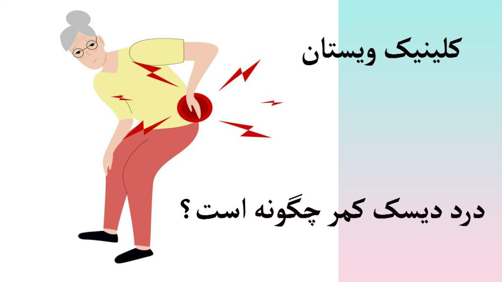 درد دیسک کمر یک خانم که درد دیسک کمر دارد-تصویر انیمیشنی است