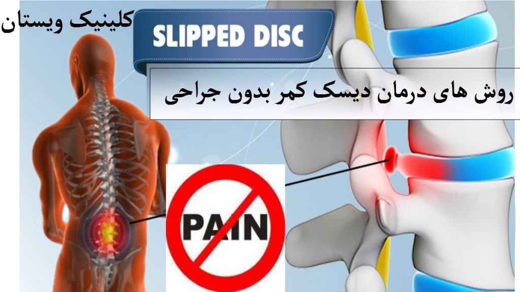 یک ستون فقرات که با ردد همراه است و یک تصویر از یک شخص