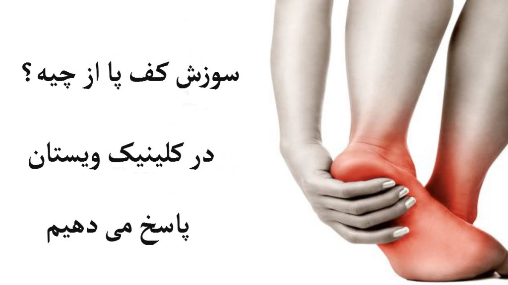 پاهای یک شخص که سوزش کف پا دارد