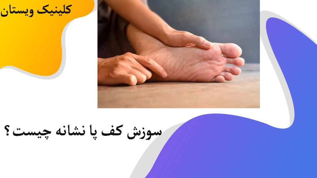 یک شخص که به علت سوزش و داغ شدن پای خود را گرفته است