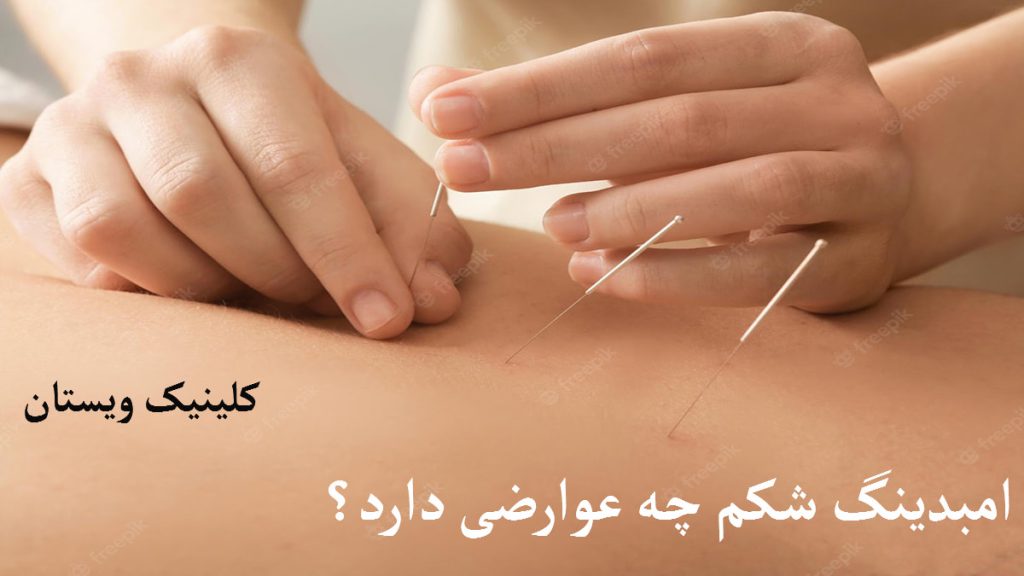 طب سوزنی شکم انجام می شود