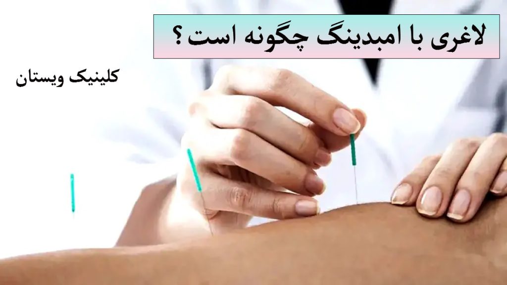 امبدینگ لاغری چیست