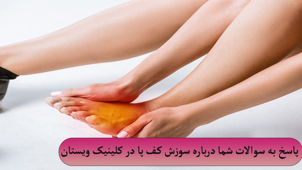 پای یک خانم که سوزش آن با رنگ قرمز مشخص شده است