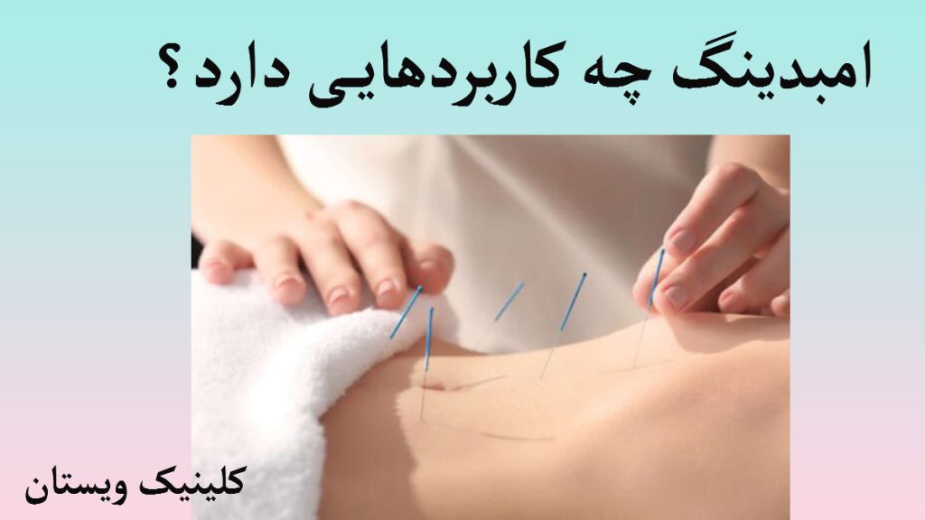 انجام طب سوزنی توسط پزشک