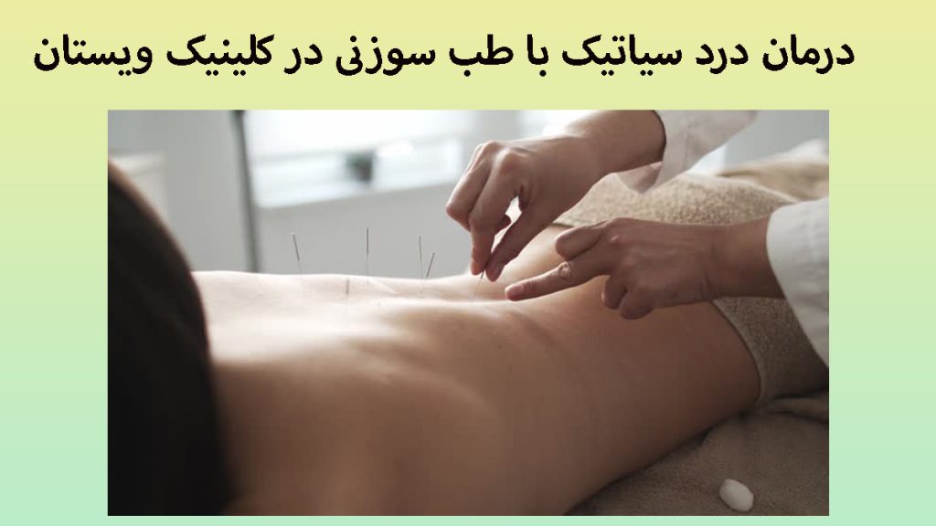 درمان سیاتیک با طب سوزنی پزشک در حال انجام طب سوزنی سیاتیک