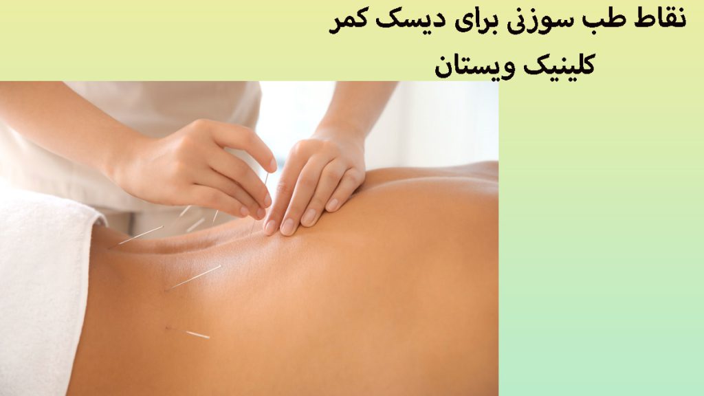 طب سوزنی کمر پزشک در حال طب سوزنی کمر