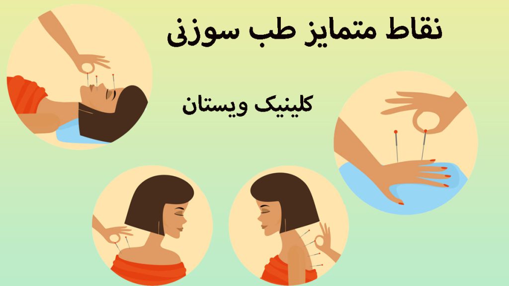 نقاط متمایز طب سوزنی چهار تصویر از طب سوزنی قسمت های مختلف بدن