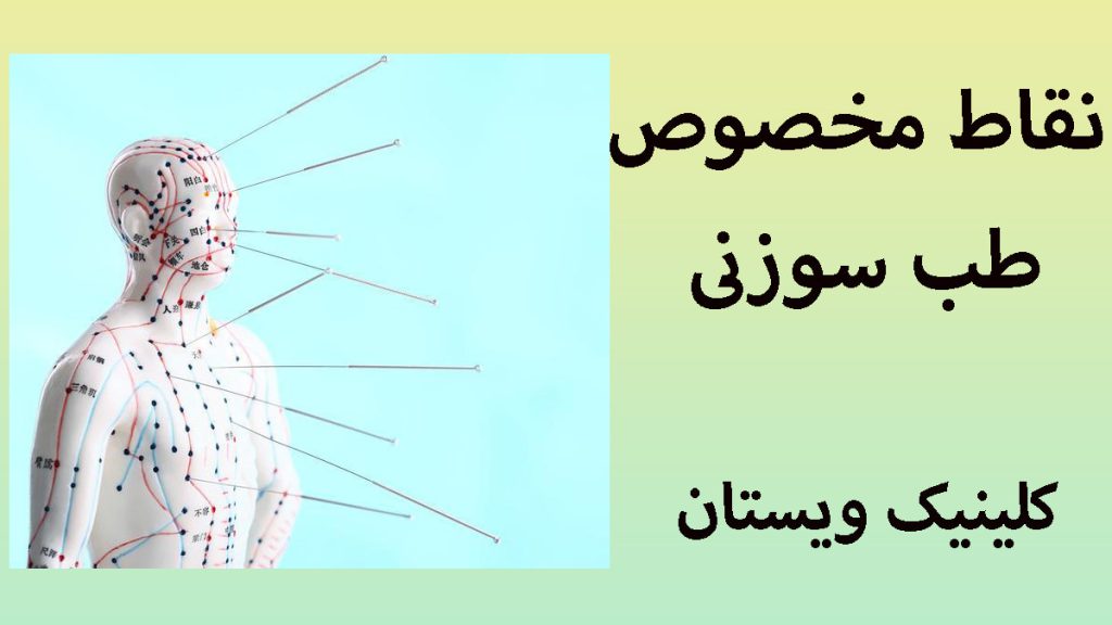 نقاط مخصوص طب سوزنی یک مولاژ بدن که نقاط طب سوزنی در آن مشخص شده است
