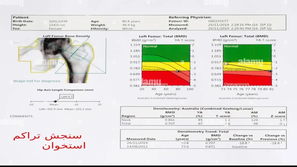 تست تراکم استخوان در کلینیک ویستان