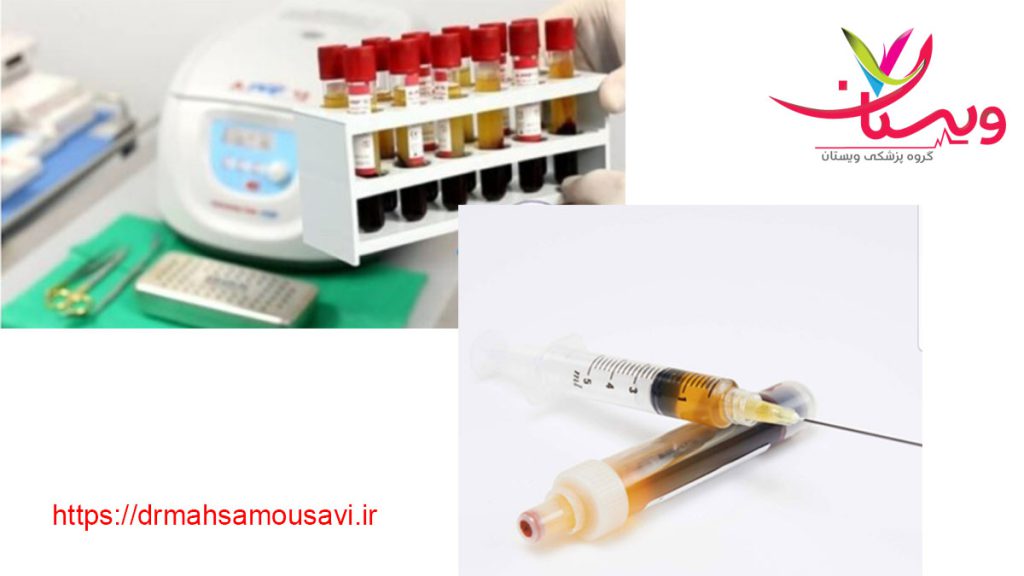 Orthokine Therapy Injection