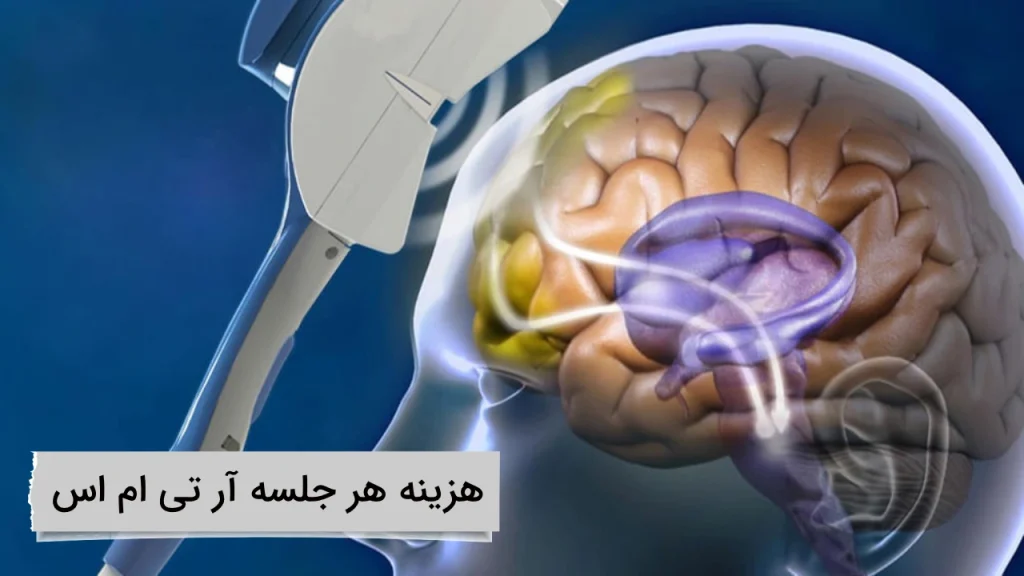 هزینه هر جلسه آر تی ام اس