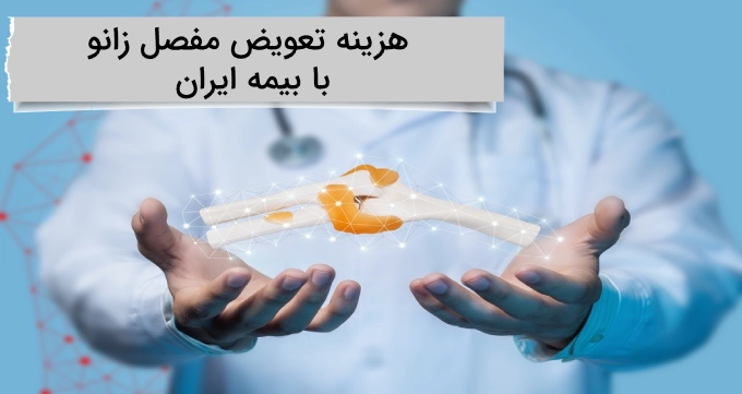 هزینه تعویض مفصل زانو با بیمه ایران