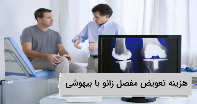 هزینه تعویض مفصل زانو با بیهوشی