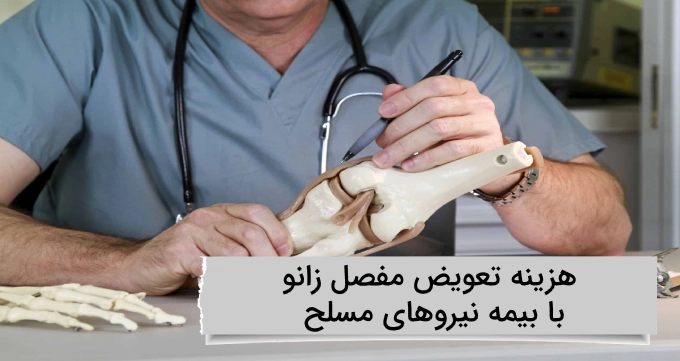 هزینه تعویض مفصل زانو با بیمه نیروهای مسلح