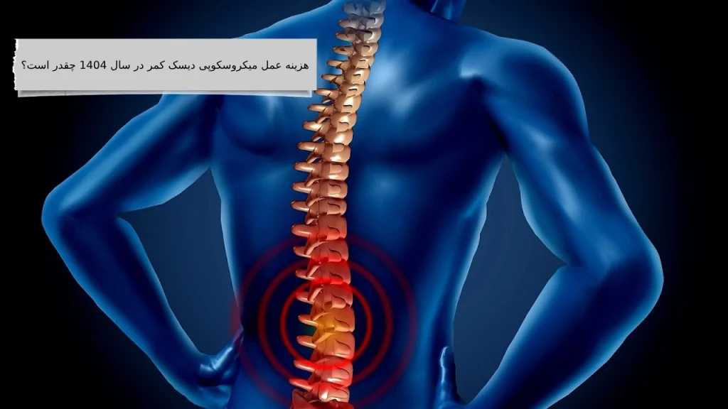 هزینه عمل میکروسکوپی دیسک کمر
