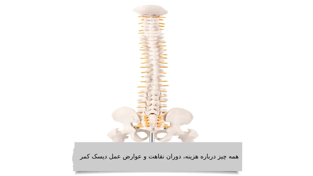 هزینه عمل میکروسکوپی دیسک کمر