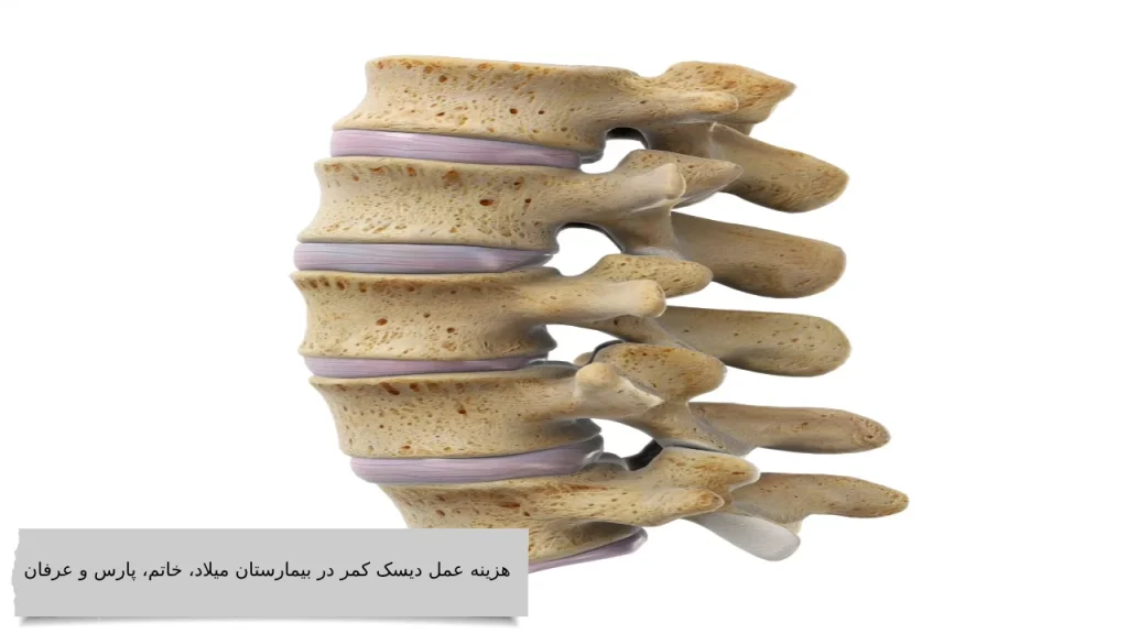 هزینه عمل میکروسکوپی دیسک کمر