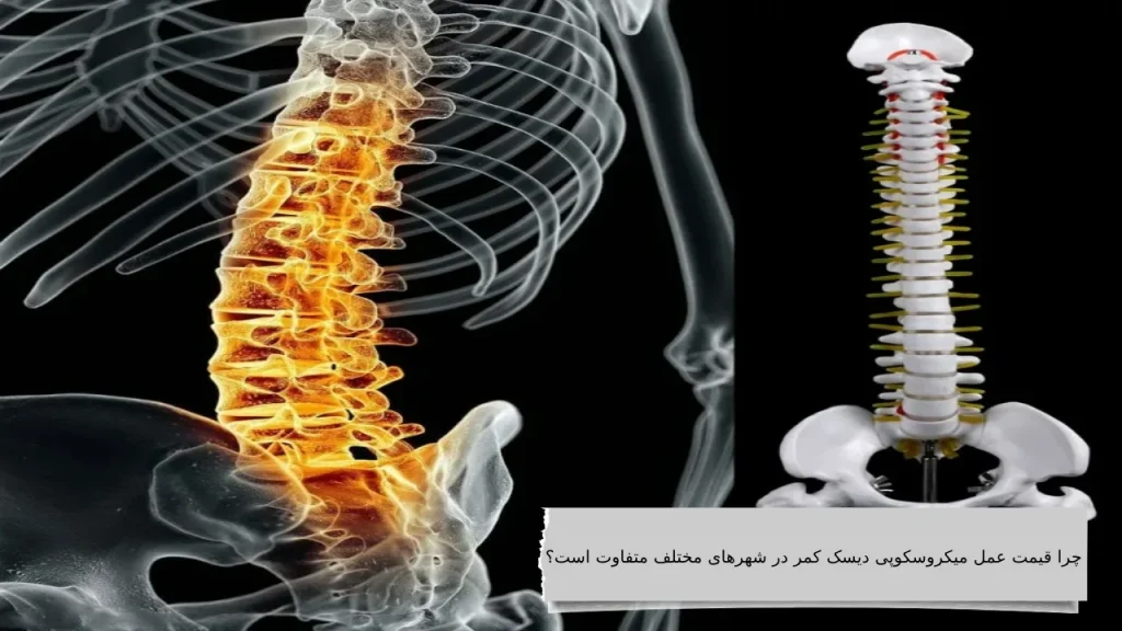 هزینه عمل میکروسکوپی دیسک کمر