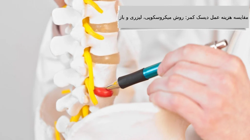 هزینه عمل میکروسکوپی دیسک کمر