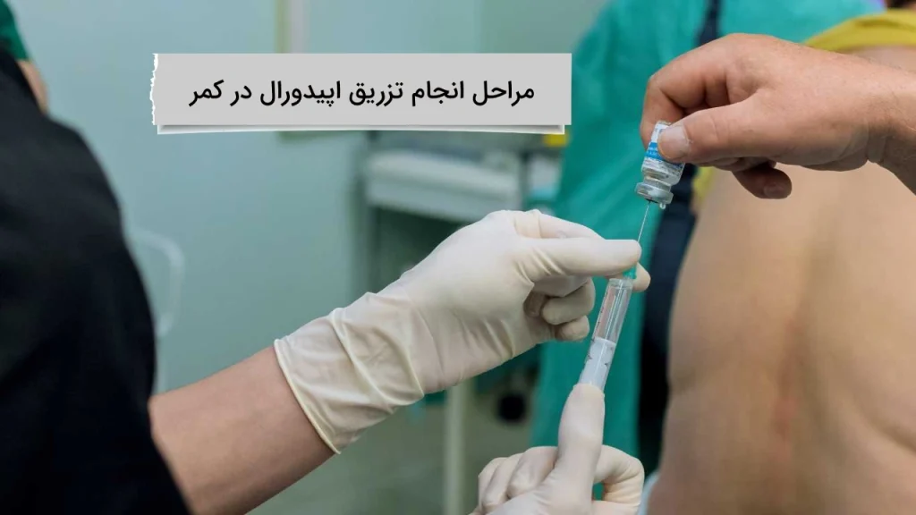 مراحل انجام تزریق اپیدورال در کمر در ویستان مراحل انجام تزریق اپیدورال در کمر