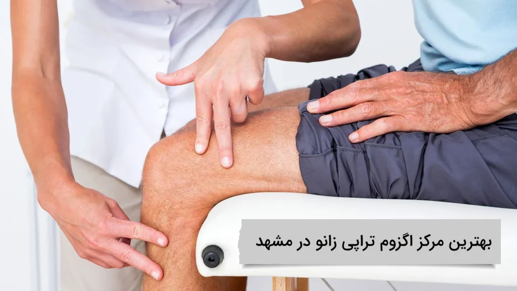 بهترین مرکز اگزوم تراپی زانو در مشهد