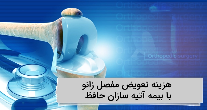 هزینه تعویض مفصل زانو با بیمه آتیه سازان حافظ
