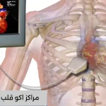 مراکز اکو قلب تهران