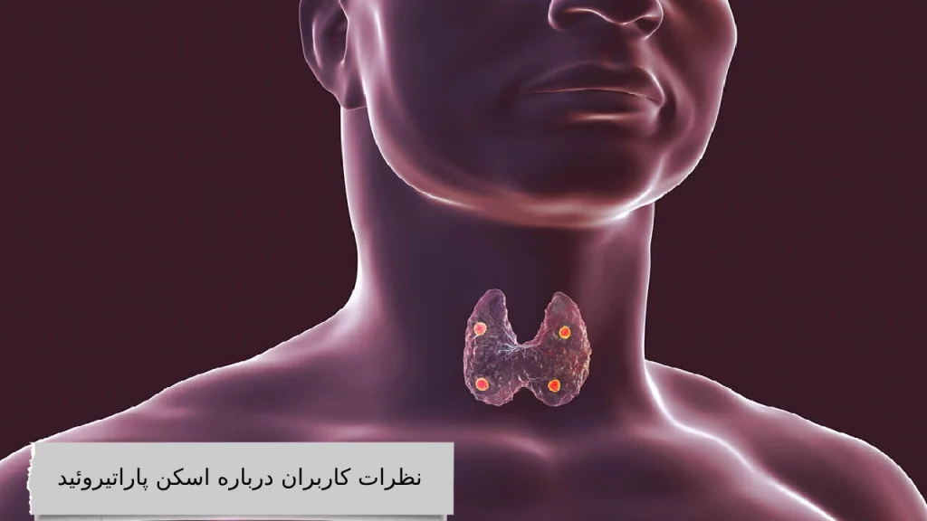 نظرات کاربران درباره اسکن پاراتیروئید چیست