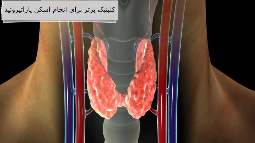 کلینیک‌ برتر برای انجام اسکن پاراتیروئید کدام است؟؟