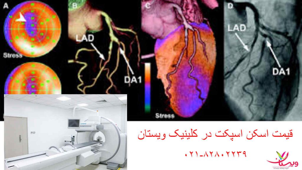 تصویر نمایشی از جزئیات هزینه اسکن اسپکت قلب در کلینیک ویستان و قیمت اسکن هسته ای را نمایش می دهد هزینه اسکن اسپکت قلب